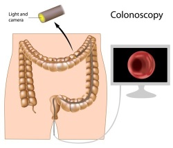 Fig1