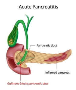 Fig30