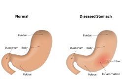 Fig24